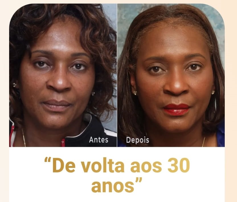 Resultado DermaNattus