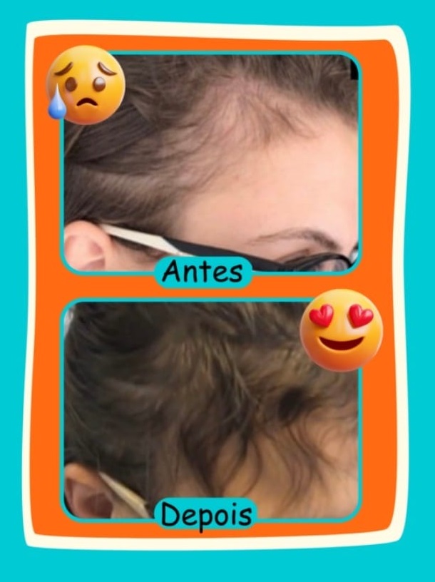 Resultado Polivitamínico
