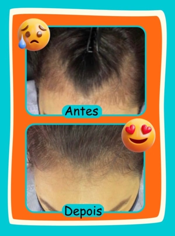 Resultado Polivitamínico